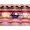 Засіб для відбілювання зубів SmileKit V34 Коректор кольору зубів 30 мл (5.3010) - Image 9