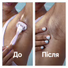 Сменные кассеты Gillette Venus ComfortGlide Breeze 6 шт. + Чехол (8700216969314) - Image 9