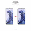 Пленка защитная Armorstandart Anti-spy Xiaomi 11T (ARM61243) - Image 3