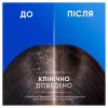 Шампунь Head & Shoulders 2 в 1 Против перхоти Свежесть ментола 400 мл (8700216305419) - Image 4