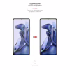 Пленка защитная Armorstandart Anti-spy Xiaomi 11T (ARM61243) - Image 3