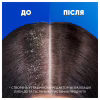Шампунь Head & Shoulders Глубокое увлажнение 400 мл (8001841406688) - Image 4