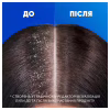 Шампунь Head & Shoulders Против перхоти Глубокое увлажнение 250 мл (8700216605281) - Image 2