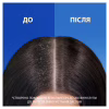 Шампунь Head & Shoulders 2 в 1 Против перхоти Свежесть ментола 330 мл (8700216304825) - Image 6