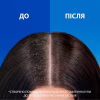 Шампунь Head & Shoulders Pro-Expert 7 Защита от выпадения волос С кофеином 250 мл (8700216156936) - Image 6