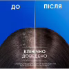 Шампунь Head & Shoulders 2 в 1 Проти лупи Яблучна свіжість 330 мл (8700216304689) - Image 6