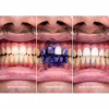 Средство для отбеливания зубов SmileKit V34 Корректор цвета зубов 30 мл (5.3010) - Image 9