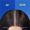 Шампунь Head & Shoulders Men Ultra Total Care 2 в 1 Комплексний догляд Проти лупи 330 мл (8700216304801) - Image 3